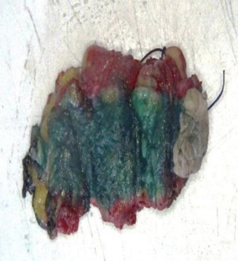 Description of the image